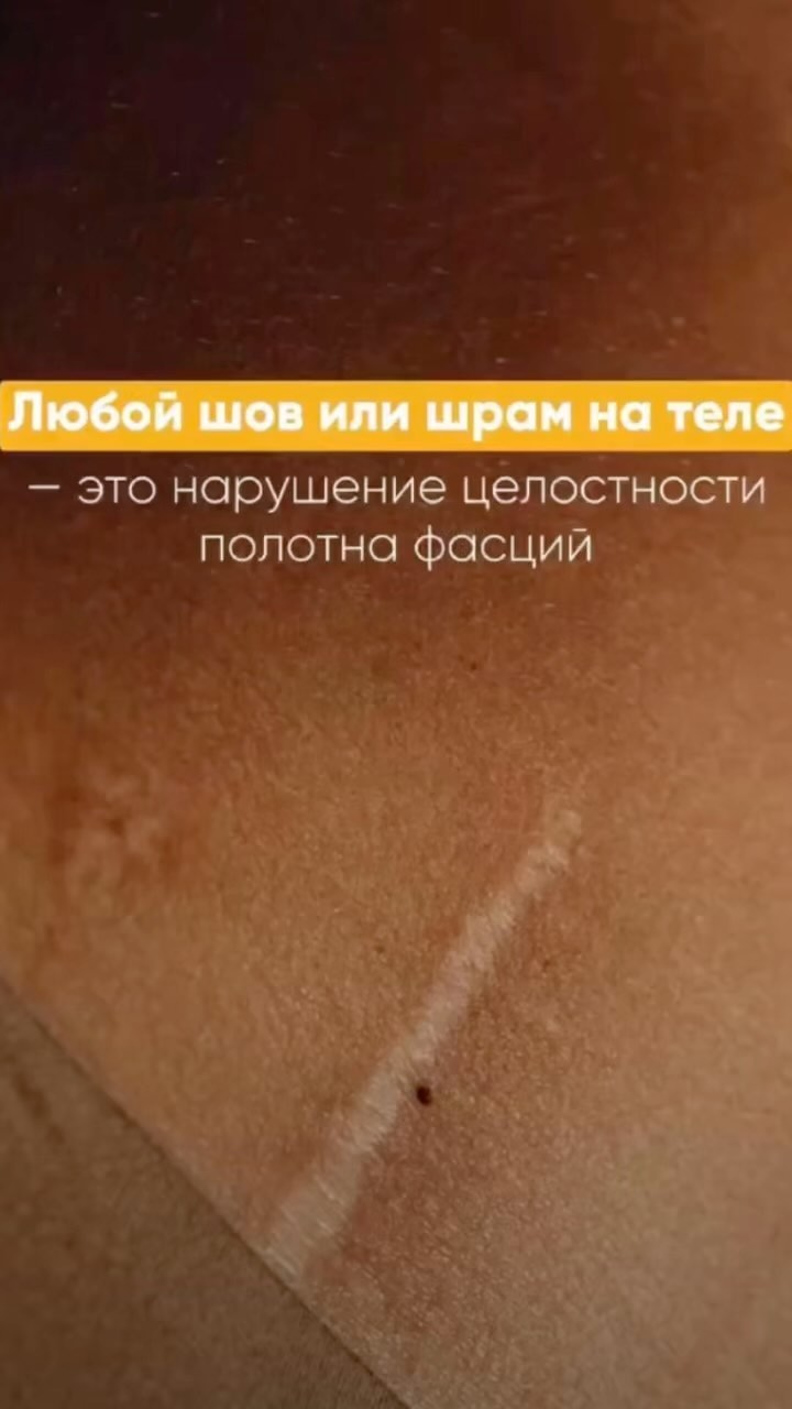 dfygt22 в LOOKY. . И ещё один важный мо...