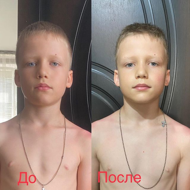 dfygt22 в LOOKY. . 1 сеанс остео… 
30 м...