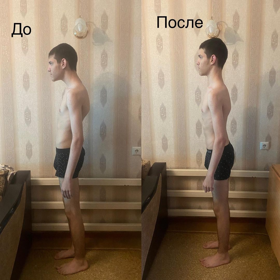 dfygt22 в LOOKY — Провели 2 сеанса и вот такой замечательный результат, продол