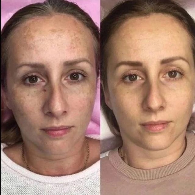 milavetrova_flax в LOOKY. #FlaxTap🔥,#салоныкрасоты,#чисткалица,#новороссийск,#анапа,#косметологанапа,#омоложение,#flaxlift,#FlaxTap,#FlaxSculpt,#flaxface,#flax,#flaxanapa,#обучениеонлайн,#обучениекосметологов,#обучениевизажистов,#краснодар,#обучение,#работа,#ресницы,#анапа,#ищумоделей. Анапа!!! Внимание!!!...