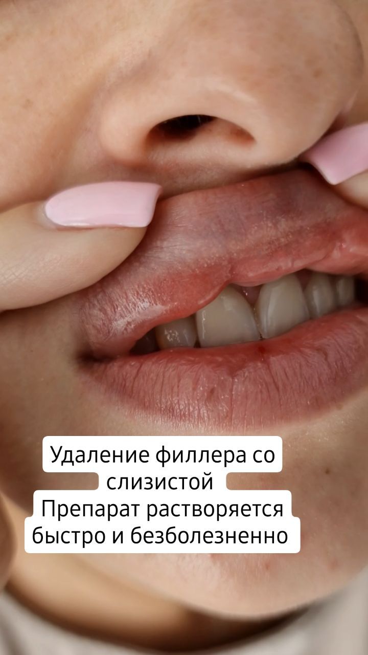 tati_cosm в LOOKY. . Выведение старого ге...
