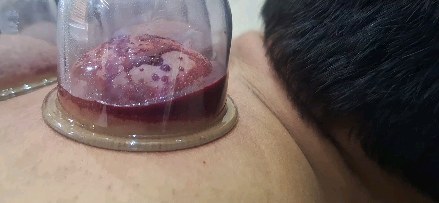 dushanbe.hijama в LOOKY. . null