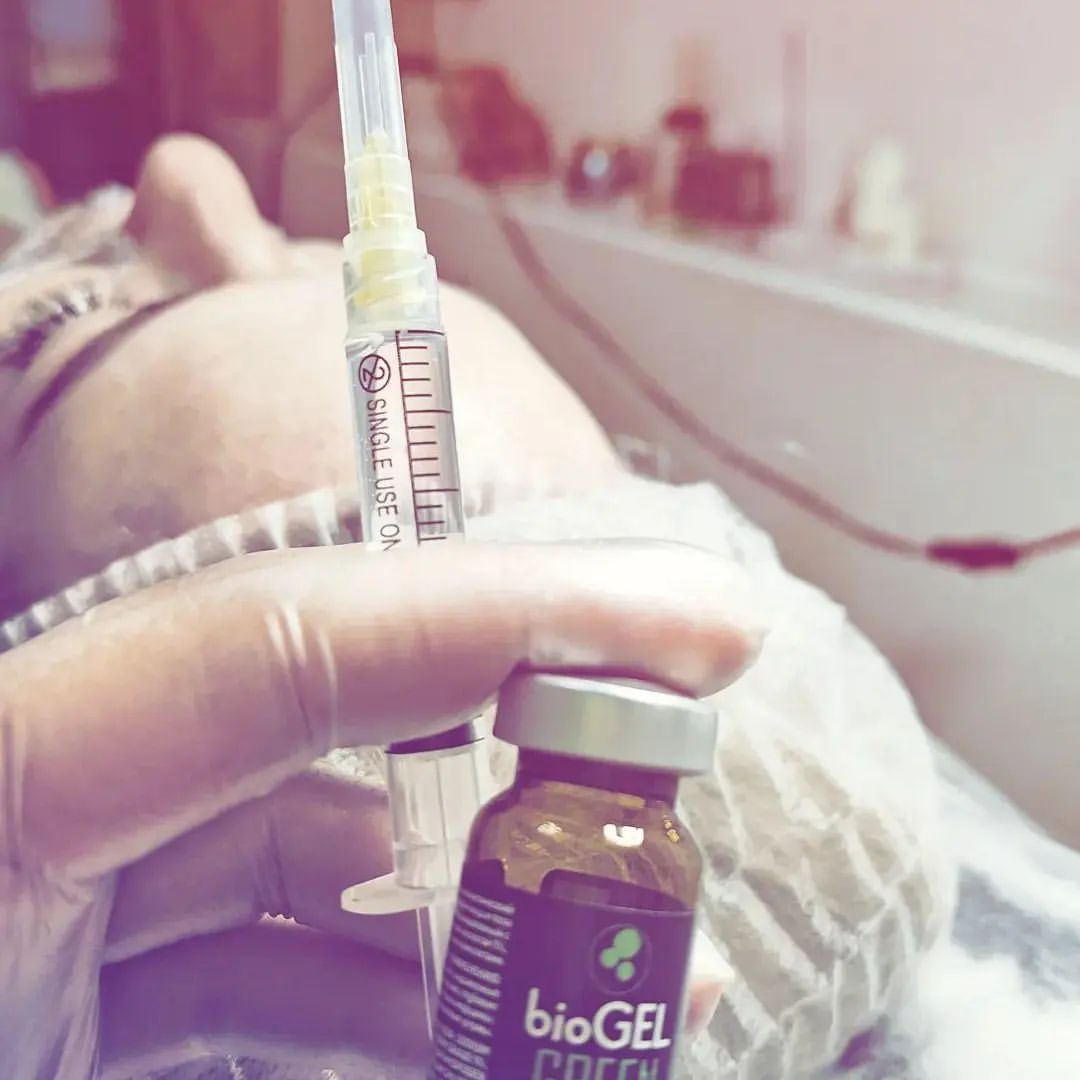 m_cosmetolog.vlg в LOOKY. #BiioGel,#биоревитализация. Антивозрастной кокте...