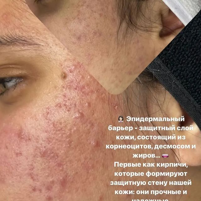 dushanbe.hijama в LOOKY. . Косметологическая хи...