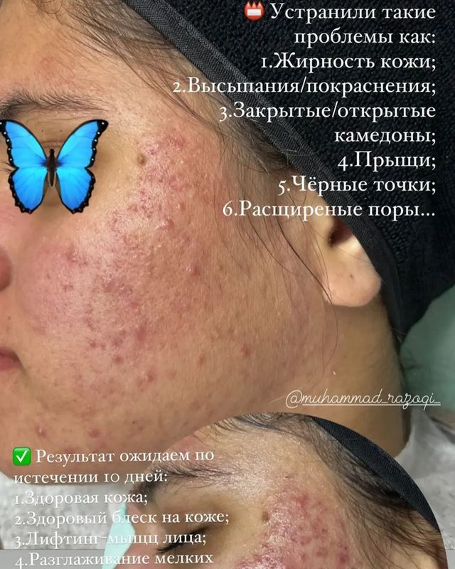 dushanbe.hijama в LOOKY. . null