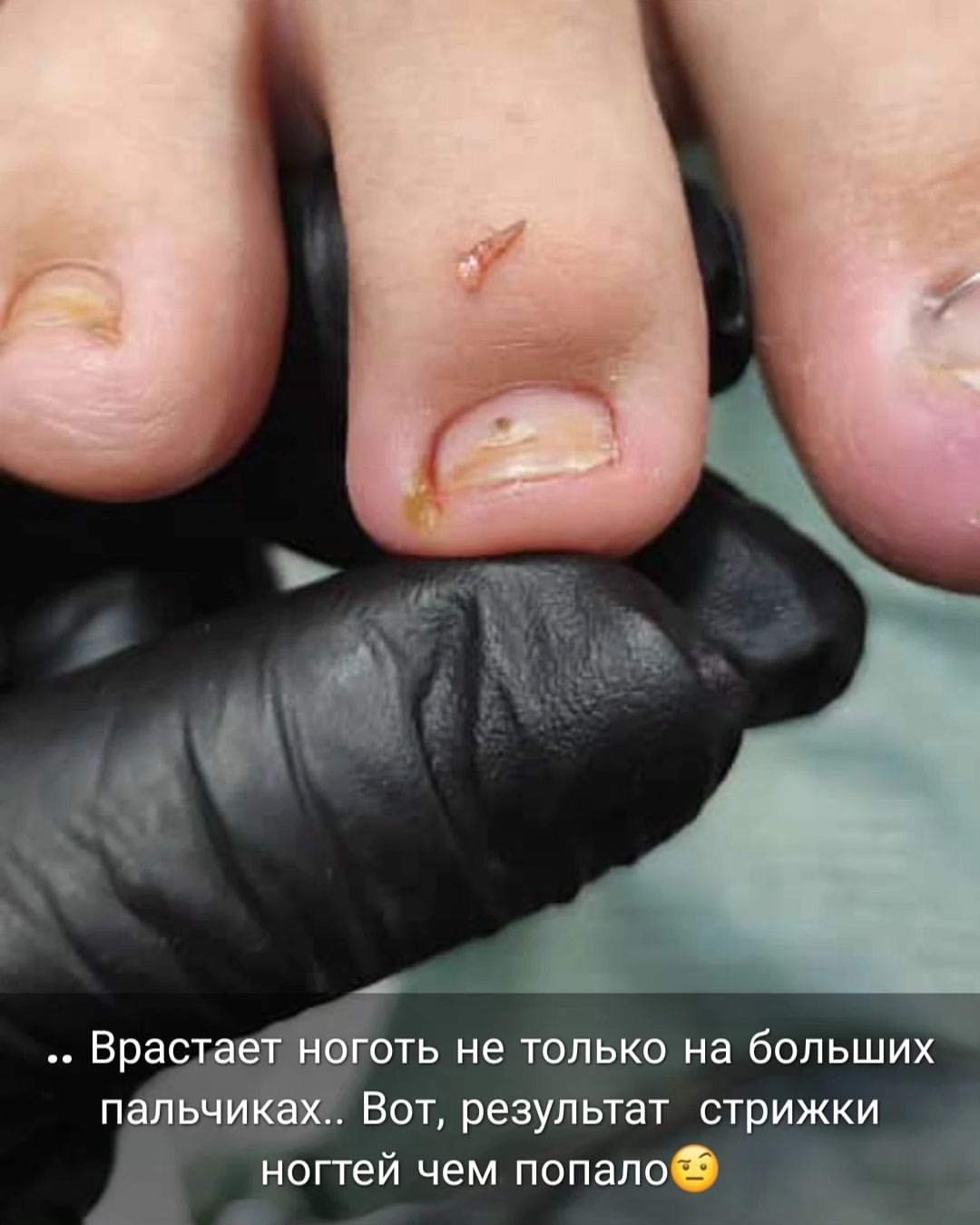 podopedicure_savranskayaa в LOOKY — фото 3