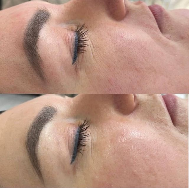 _tvoy_cosmetic_ekb в LOOKY. . На нижнем фото резул...