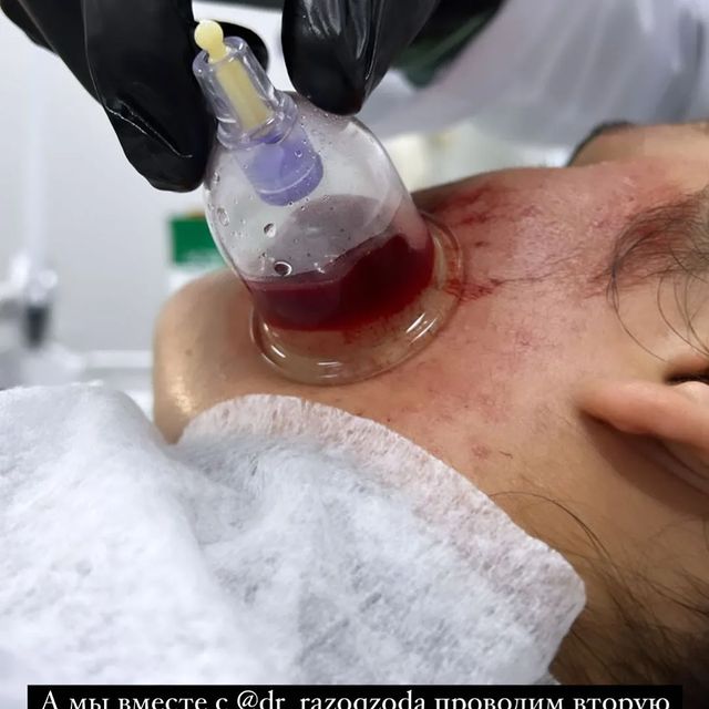 dushanbe.hijama в LOOKY. . null