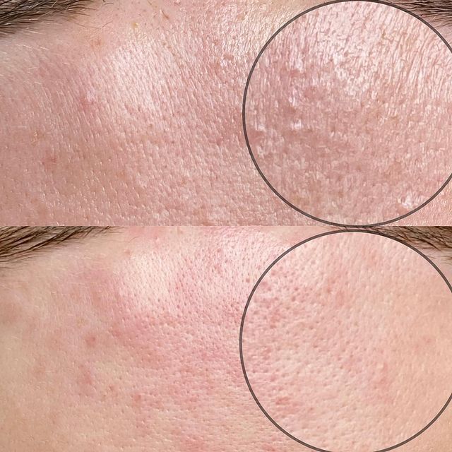 _tvoy_cosmetic_ekb в LOOKY. . Комбинированная чист...