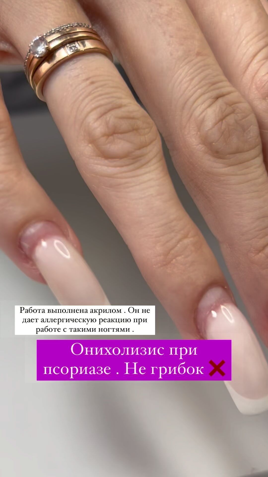 sew_by_oksa в LOOKY. #ногтисочи,#акрилсочи,#наращиваниеногтейсочи. Обычный день мастера...