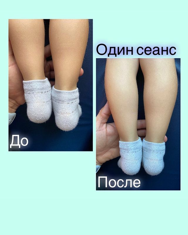 rostislav_celitel в LOOKY. #юмейхо,#массажтемрюк,#костоправтемрюк,#здоровьетемрюк. Будьте внимательны к...
