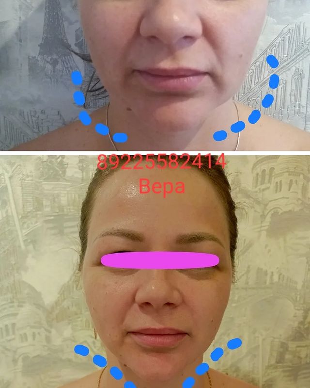 massageinoren в LOOKY. #хочупохудеть,#хочукрасивоетело,#хочумассаж,#обертываниевподарок,#выезднадом,#массажоренбург,#массаждома,#будьтездоровы,#стройнеемсверой,#ненавреди,#комплексныйподход,#всемдобра✌,#Vera,#massage,#xudeem,#stroineemveselo,#anticellulite,#мед,#массажувасдома,#доипосле,#профи,#худеемсбольшихобъёмов,#похудела,#массажорен,#талия,#результат,#люблюсвоюработу,#слюбовьюотvera,#massage,#xudeem,#марафон. Девчата мои ❤, с раз...
