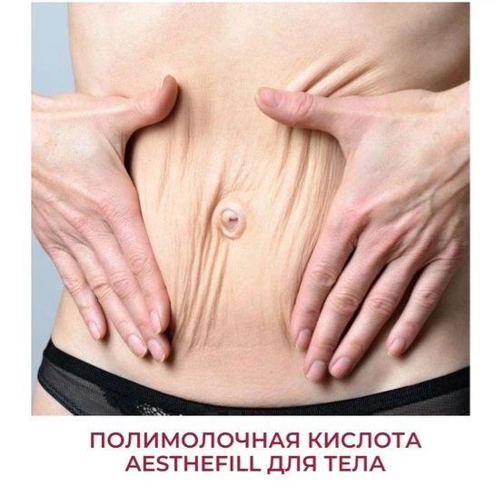reline_education in LOOKY. . Филлер AestheFill мо...