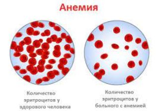 julia.wellbeing в LOOKY. #АНЕМИЯ,#род. #АНЕМИЯ с точки зрен...