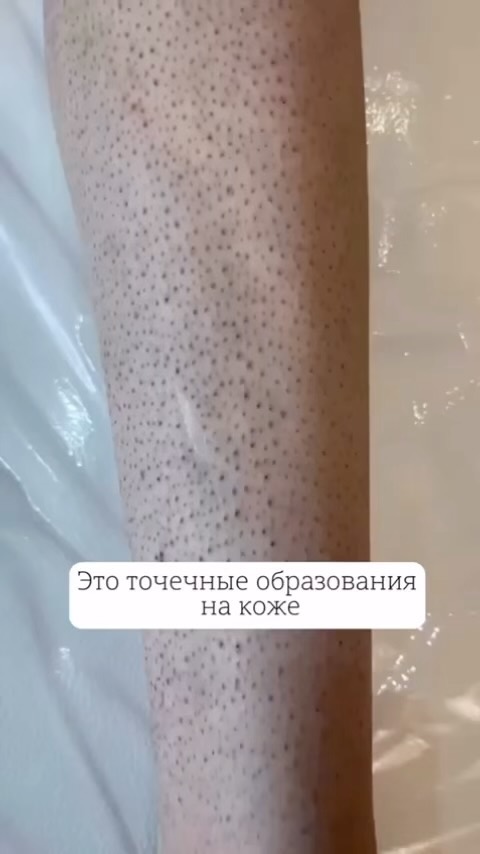 manelaser_tuapse в LOOKY. #лазернаяэпиляция,#лазер,#эпиляция,#туапсеновости. Пора начать делать л...