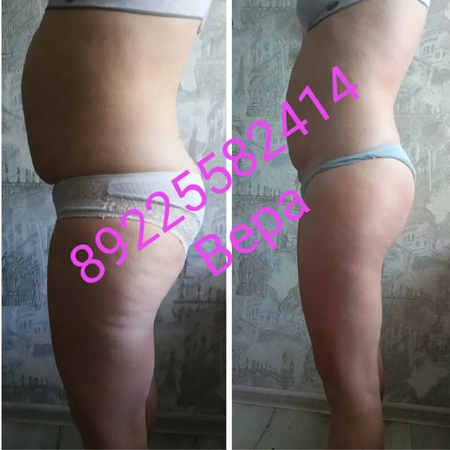 massageinoren в LOOKY. #хочупохудеть,#хочукрасивоетело,#хочумассаж,#обертываниевподарок,#выезднадом,#массажоренбург,#массаждома,#будьтездоровы,#стройнеемсверой,#ненавреди,#комплексныйподход,#всемдобра✌,#Vera,#massage,#xudeem,#stroineemveselo,#anticellulite,#мед,#массажувасдома,#доипосле,#профи,#худеемсбольшихобъёмов,#похудела,#массажорен,#талия,#результат,#люблюсвоюработу,#слюбовьюотvera,#massage,#xudeem,#марафон. К Новому Году красив...