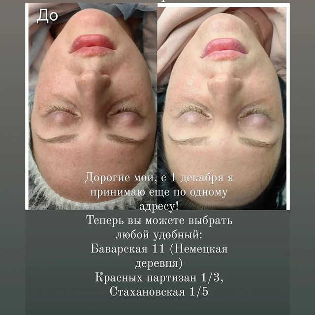 antonina.cosmetologist в LOOKY. . null