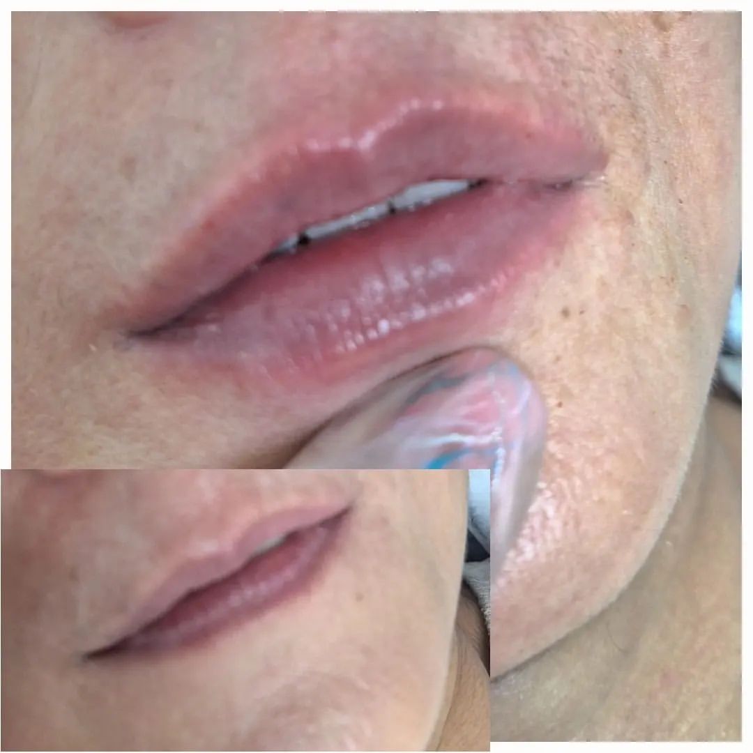 m_cosmetolog.vlg в LOOKY. #губы,#увеличениегуб. Красота в натурально...