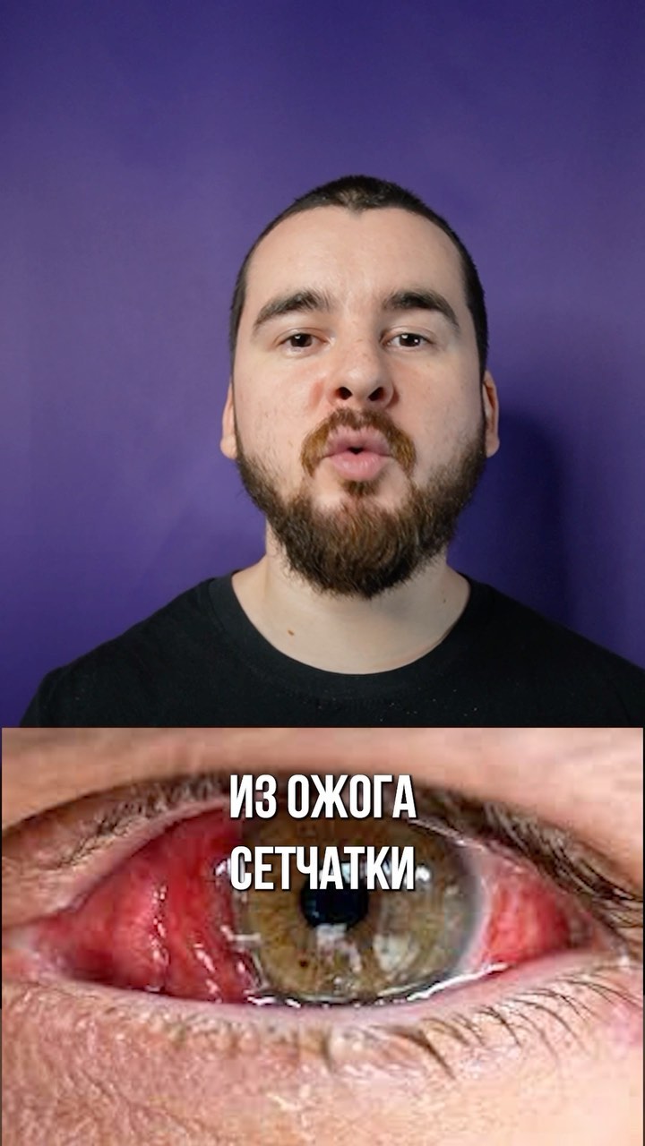 topfackt в LOOKY. . Что будет если смотр...