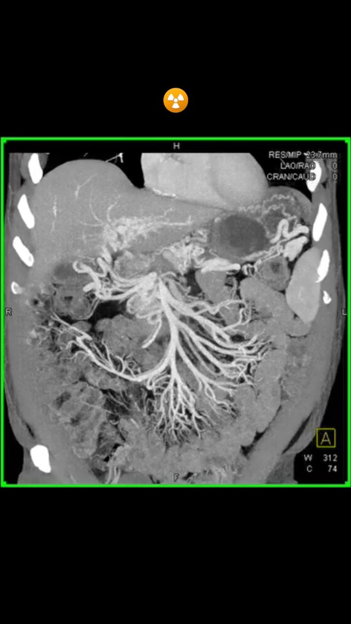 pod_radioo в LOOKY. #radiologiaporamor,#radiologia,#raiosx,#tomografiacomputadorizada. Magnífico 👏🏾☢️❤️
....