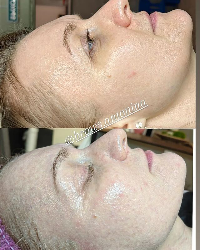 antonina.cosmetologist в LOOKY. . Курс омолаживающего ...