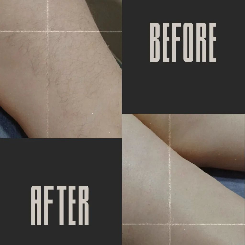 krasova_wax в LOOKY — #депиляция#депиляциявоском#депиляцияворонеж#сахарвоск#ваксин