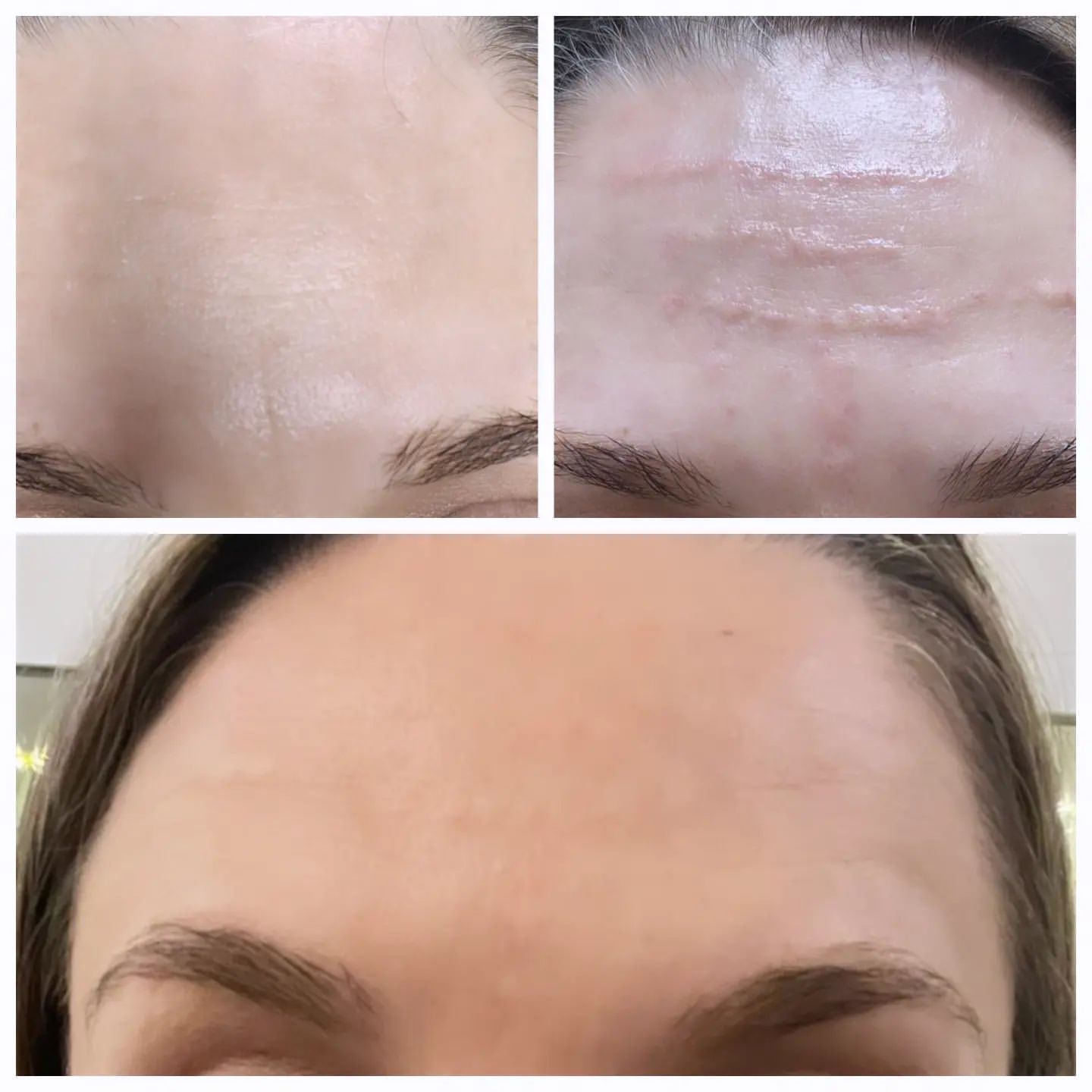 m_cosmetolog.vlg в LOOKY. . Работа по заломам Bi...