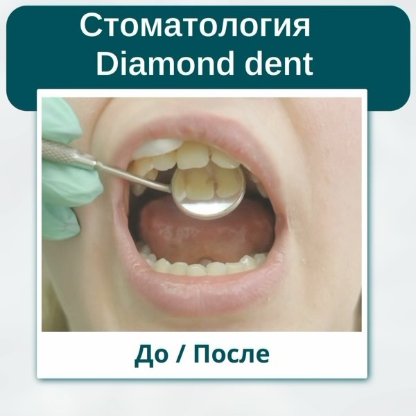 diamond_dent_73 в LOOKY. #допослестоматолог,#стоматология,#стоматологтерапевт,#лечениезубовульяновск,#стоматологульяновск. #допослестоматолог #...
