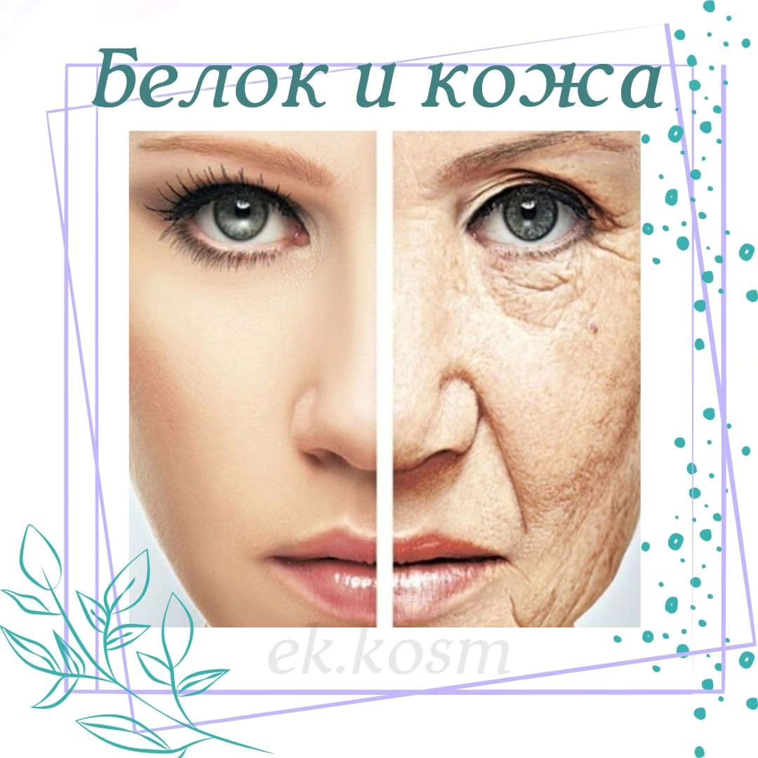 Белок (он же протеин) – это основной строительный материал организма. 

Кроме того, что белок играе важную роль в обменных процессах организма, это ещё и наша красота‼️

Сухость кожи и появление морщин( эластоз), тоже  показатель дефицита белка. 

Почему необходимо заботиться о том, достаточно ли белка получает наш организм?

Вот несколько причин:

-  Протеин является составляющей каждой клетки организма. Фактически наши волосы и ногти состоят практически из одного белка;

-  Ваше тело использует белка для формирования и восстановления ткани;

-  Белки необходимы для образования ферментов, гормонов и других химических веществ;

-  Белки – это важный элемент в формирование костей, мышц, хрящей, кожи и крови.

Также, как и углеводы и жиры, белки являются «макроэлементами», что значит, что нашему организму они необходимы в большом количестве для того, чтобы оставаться здоровым. Витамины и минералы, которые необходимы нашему организму в небольшом количестве, называются «микроэлементами». 

Кто в группе  риска :
✔️вегетарианцы 
✔️люди на монодиете или  голодании
✔️страдающие заболеванием почек 
✔️заболевание пищеварительных органов 
✔️люди, профессии которых связана с большой физ нагрузкой
✔️гипотиреоз 
✔️люди старше 60 лет.

Как восполнить❓

Продолжение в карусели, листай⏩⏩⏩

#красивоетело #косметологянтарный #красивыегубкиянтарный #биоревитализацияянтарный #лазернаяэпиляция #нутрициологиякосметолргия #ешьи худей # lpgянтарный #кавитацияянтарный #детокспрограммы #vertera #янтарный #изумрудный #восточный