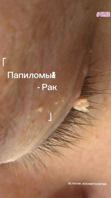 beauty_cosmetolog_ru в LOOKY. . Достаточно распростр...