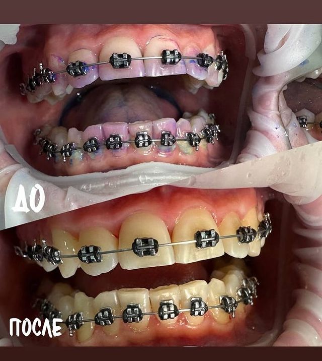 dr.yaroslavtceva в LOOKY. . ❗️Если Вы носите бре...
