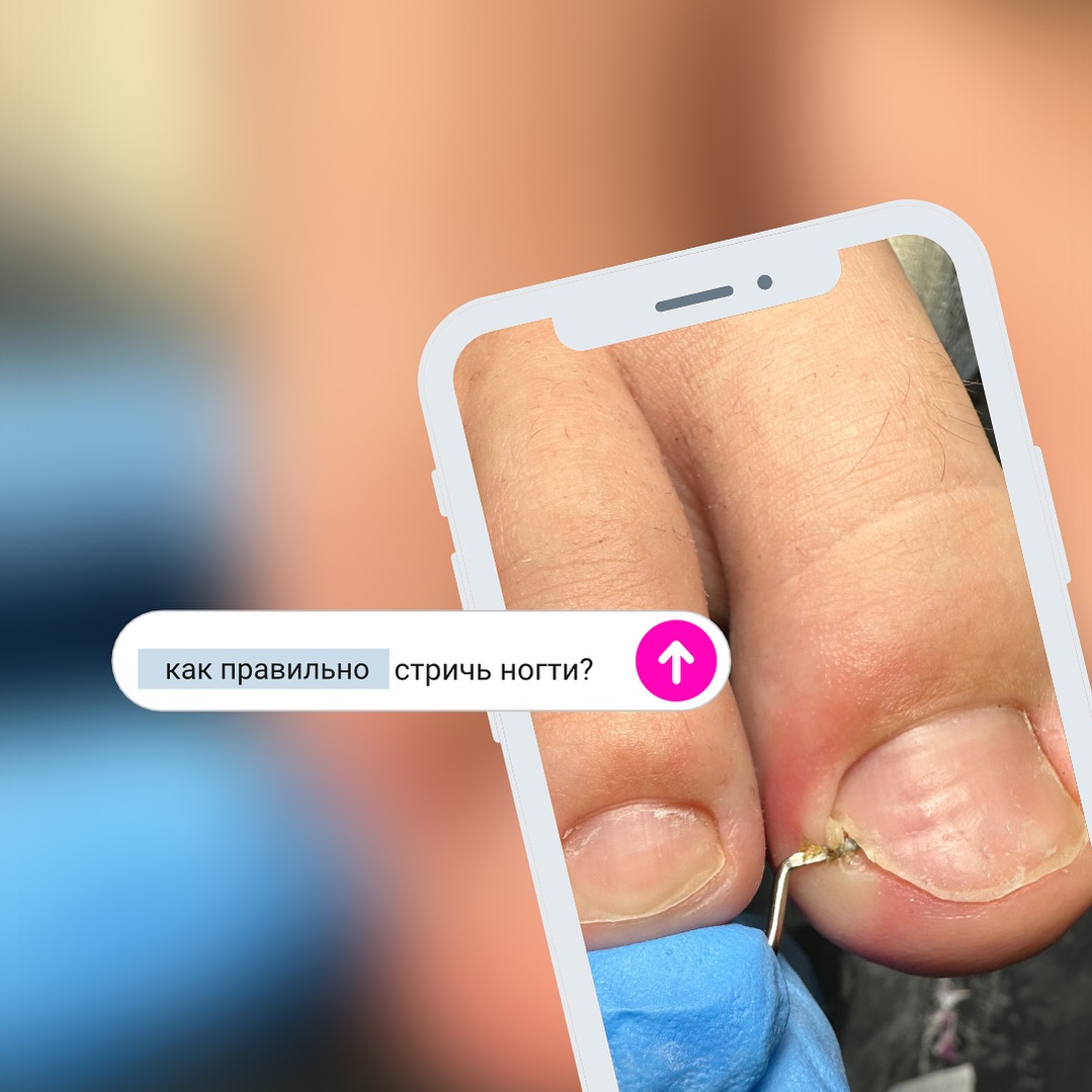 laconica_pedicure в LOOKY — Не лезь! Отрежут палец! 

Один из важных пунктов, который до