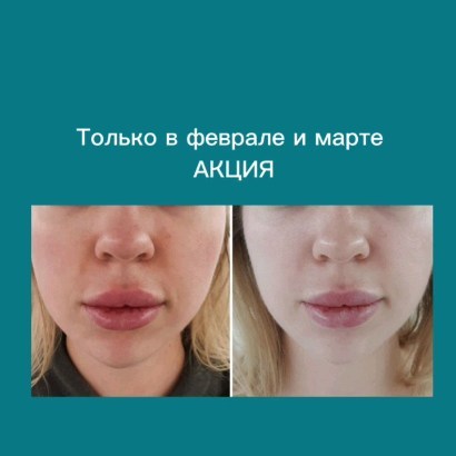dr.mariakarpova в LOOKY. . АКЦИЯ только в февра...
