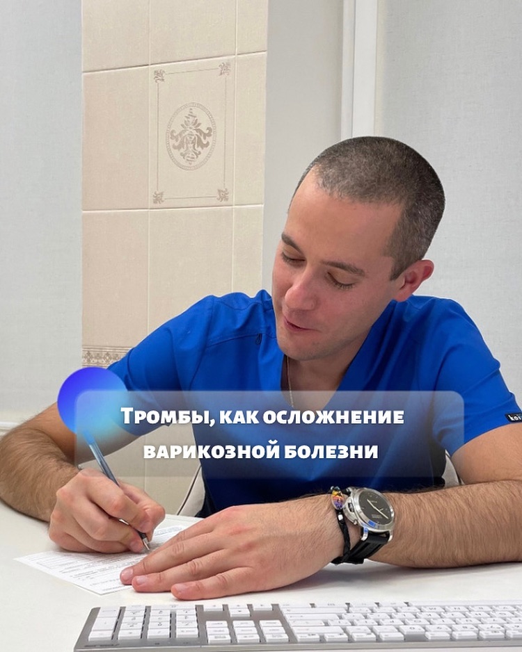 Тромбы как осложнения варикозной болезни. 

📖 Итак разберем в чем основа тромбообразования, их разработал ученый Вирхов еще в 19 веке и получили название как триада Вирхова. 

Основная идея заключется в наличие 3 факторов:
1️⃣ замедления тока крови;
2️⃣ повреждение сосудистой стенки как изнутри так и снаружи;
3️⃣ нарушения в свертывающей системе крови) и при сочетании хотя бы двух факторов запускается процесс образования тромба. 

Таки образом все пациенты у которых есть варикозная болезнь есть застой венозной крови, то есть, один из факторов уже есть. 

Остается чтобы добавился еще один из триады и процесс запускается. По поводу повреждения сосудистой стенки 🦵🏼наиболее яркий пример может стать любая вирусная инфекция 🦠 и чем тяжелее человек болеет, тем сильнее сосудистую стенку повреждают токсины, что увеличивает риск тромбообразования. 

Так же травмы к примеру переломы, так же довольно часто приводят к риску тромбоза. 

❗️Потому на вопрос как избежать тромбоз то ответ тут очевиден, нужно избавиться от варикоза.