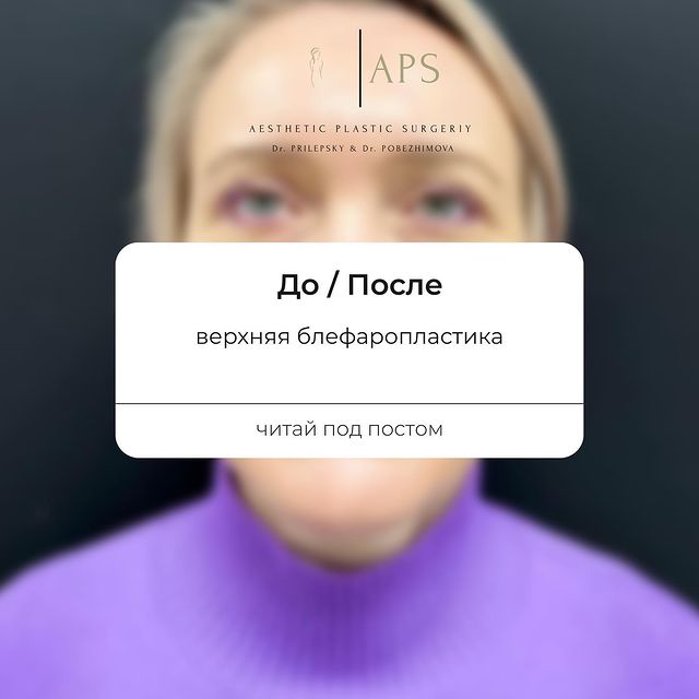 doctor_prilepskiy в LOOKY. . «Глаза как страж зан...