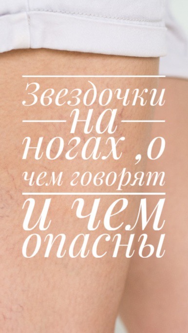 marinasw_rnd в LOOKY. . Сосудистые звёздочки...