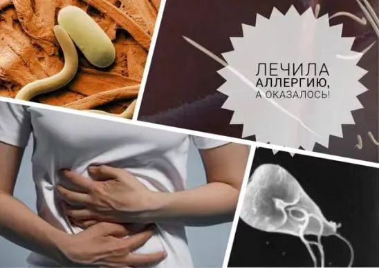 nazgul_sw_ufa в LOOKY. . Паразиты часто скрыв...
