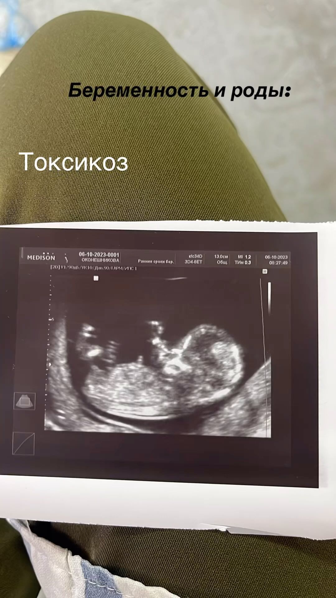 _lenkaok_ в LOOKY. . Саатар биир схваткан...