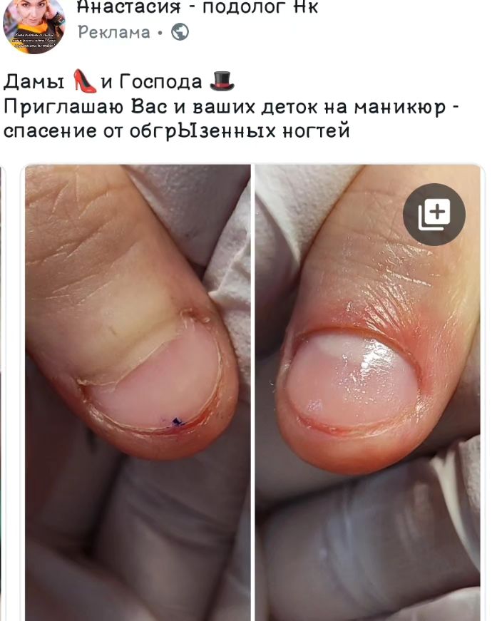podopedicure_savranskayaa в LOOKY. #маникюр_маркс,#детскийманикюр,#мужскойманикюр,#марксманикюр,#подологиясаратов,#подологмаркс. Дамы👠и Господа 🎩!
...