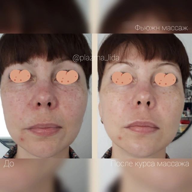 plazma_lida в LOOKY. #plazma_lidaмассаж,#омоложениезлатоуст,#массажзлатоуст,#златоустмассаж,#златоустлечение,#лечениезлатоуст,#златоуст. Фьюжн массаж. 
Компл...