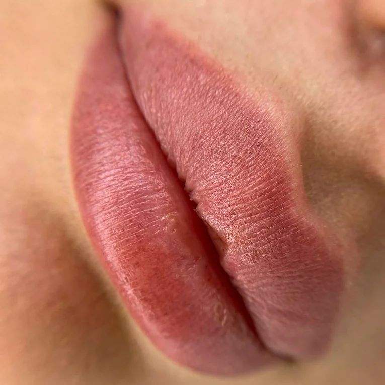 dr.evgeniapavlova в LOOKY — Зажившие губы🥰
ЛУЧШЕЕ ВЛОЖЕНИЕ - ВЛОЖЕНИЕ В СЕБЯ 🙈

Когда 