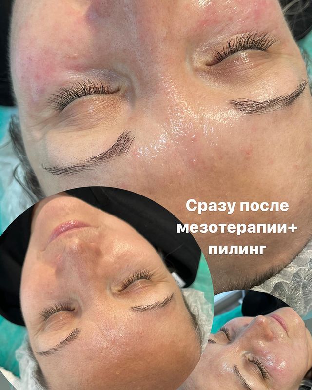 kosmetolog_chel_zharkih в LOOKY. . null