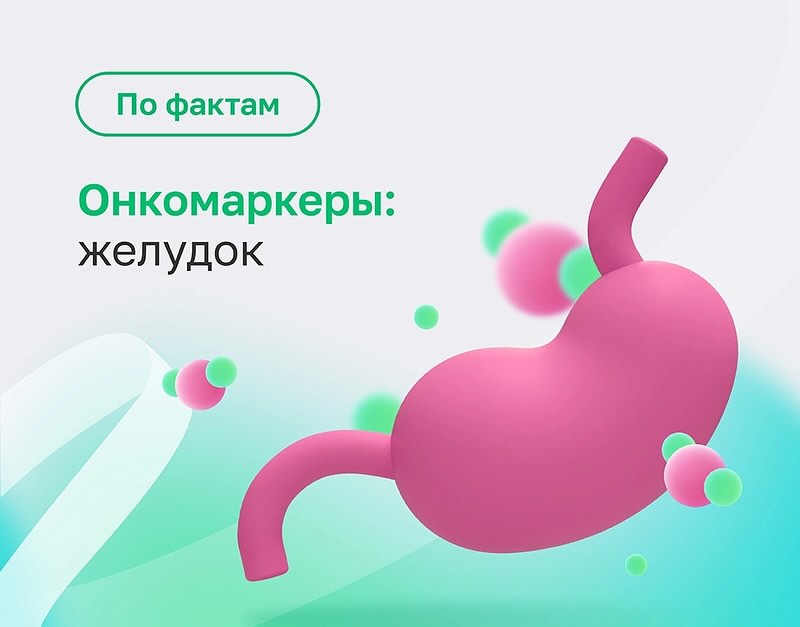 🧪Онкомаркеры и ранняя диагностика заболеваний желудка 
 
Онкомаркеры – это вещества, которые могут присутствовать в крови в повышенном количестве при развитии рака или других злокачественных новообразований. 
 
Какие существуют исследования на онкомаркеры заболеваний желудка? 
 
Раковый эмбриональный антиген (РЭА). Онкомаркер, который повышается при злокачественных новообразованиях желудка, толстого кишечника, прямой кишки, поджелудочной железы. 
 
CA 19-9. Онкомаркер, который применяется в диагностике рака желудка, поджелудочной железы, желчного пузыря. 
 
CA 72-4. Онкомаркер, который часто используют для мониторинга эффективности лечения рака желудка и выявления рецидивов. 
 
Хотя существует более 150 различных онкомаркеров, не все они одинаково репрезентативны в диагностике. Назначать нужное исследование должен лечащий врач. 
 
В каких случаях назначают анализ на онкомаркеры желудка? 
 
➡Профилактическое обследование. При наличии факторов риска развития рака желудка, например хронического гастрита, наследственной предрасположенности, возрасте старше 50 лет. 
 
➡Обследование при наличии симптомов: 
🔴 Постоянная боль в животе 
🔴 Изжога, тошнота, рвота 
🔴 Необъяснимая потеря веса 
🔴 Изменения в стуле (кровь в кале) 
🔴 Чувство сытости после небольшого приема пищи 
🔴 Анемия 
 
➡Мониторинг эффективности лечения: после операции или химиотерапии при раке желудка для отслеживания динамики заболевания. 
 
Ранняя диагностика заболеваний желудка очень важна. Она позволяет выявить проблему до появления серьезных симптомов и начать своевременное лечение, что значительно повышает шансы на полное выздоровление и предотвращает развитие осложнений. 
 
Комплексно оценить состояние желудка и обнаружить атрофические изменения и предраковые состояния на ранних стадиях поможет комплексный анализ Гастроскрин. 
Это исследование крови дает возможность выявить наличие бактерии Helicobacter pylori – основной причины хронического гастрита, язвенной болезни желудка и рака желудка. 
 
Сдайте анализы в Хеликс быстро и в комфортной обстановке. Подробности об анализах уточняйте на сайте и по т. +7 800 700 03 03 или спрашивайте в комментарии к посту.