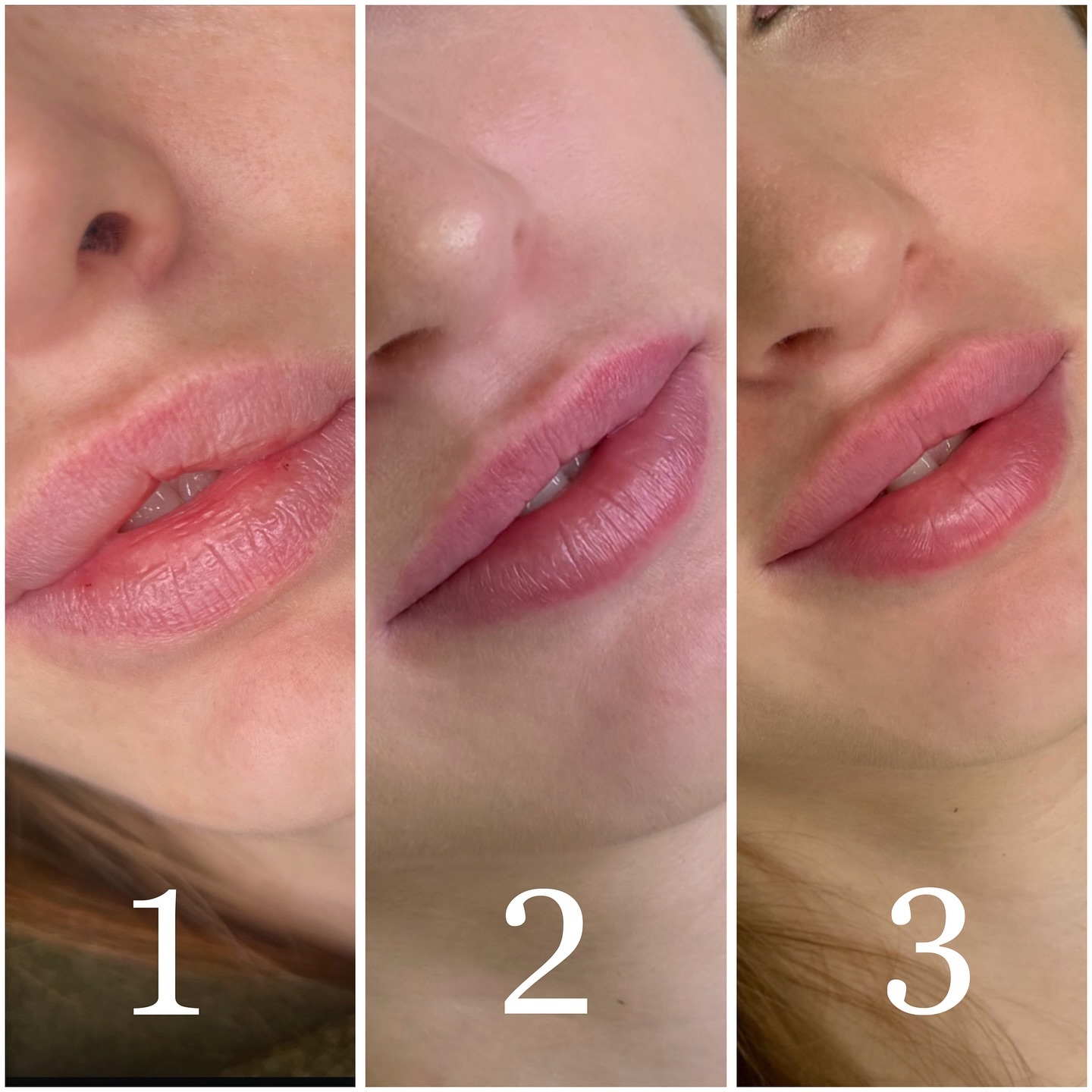 esthetic.face.ekb в LOOKY. #Екатеринбург,#губыЕкб,#контурнаяпластика,#губы,#коррекциягуб,#косметология,#уходзасобой. ✨Преображение губ✨

...