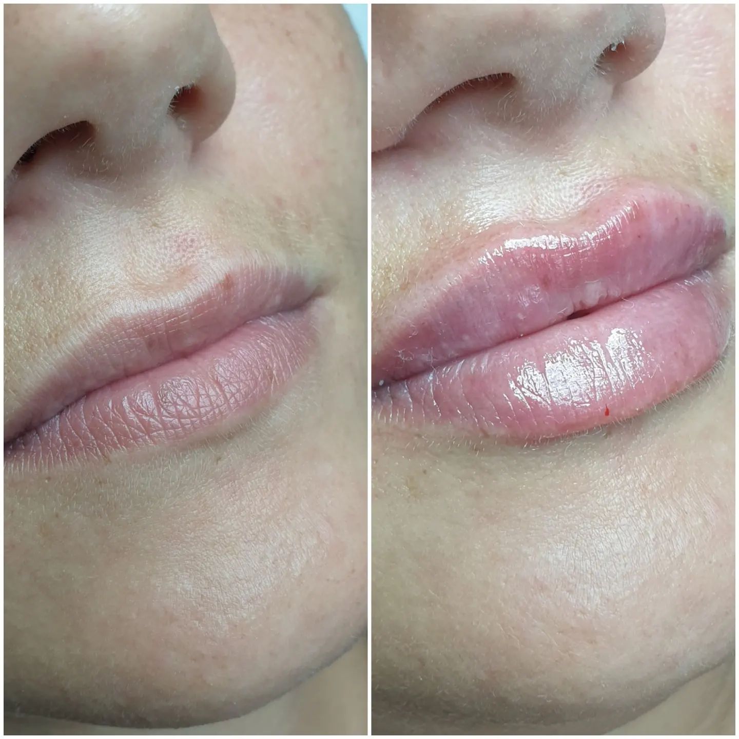 beautiful_skin_vl в LOOKY. #губывладивосток💋💋💋. #губывладивосток💋💋...