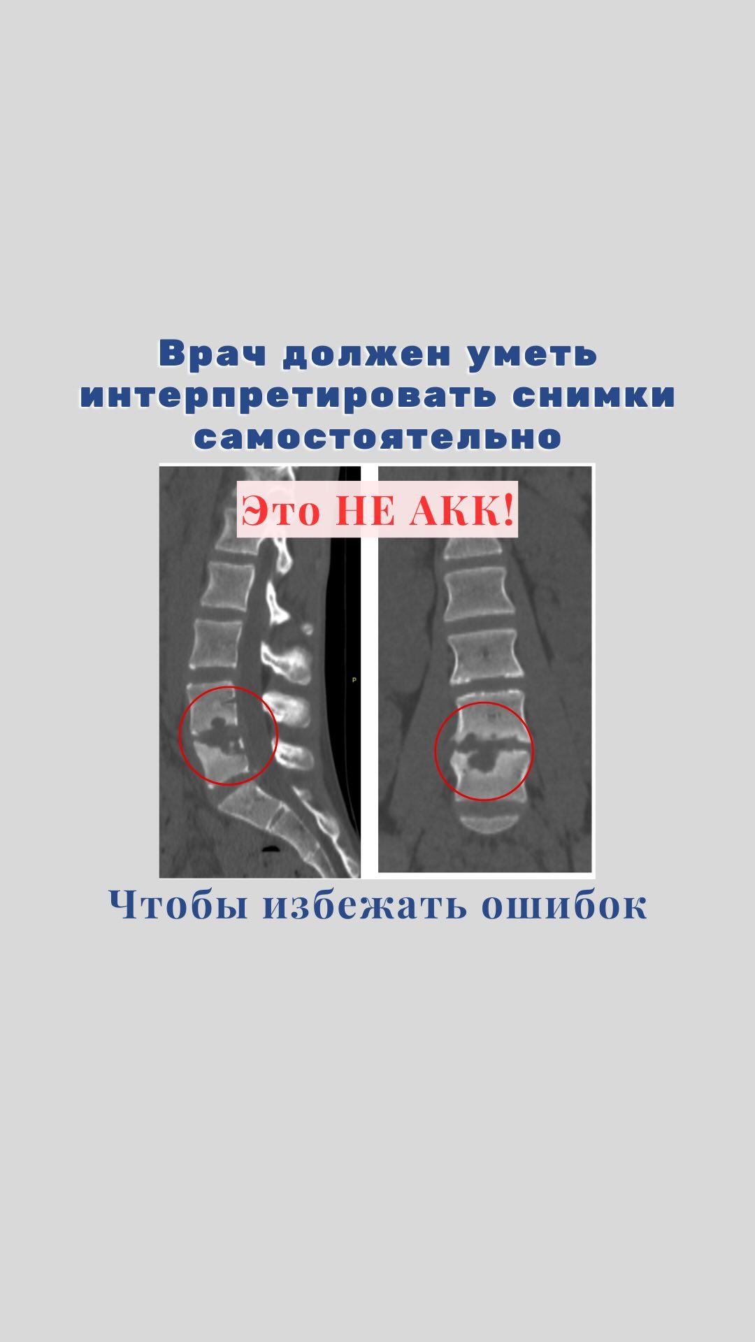 doc_malamashin в LOOKY. #Мрт#кт#исследование#случай#история#мнение#ортопедспб#детскийортопед#дети. Я никогда не читаю з...