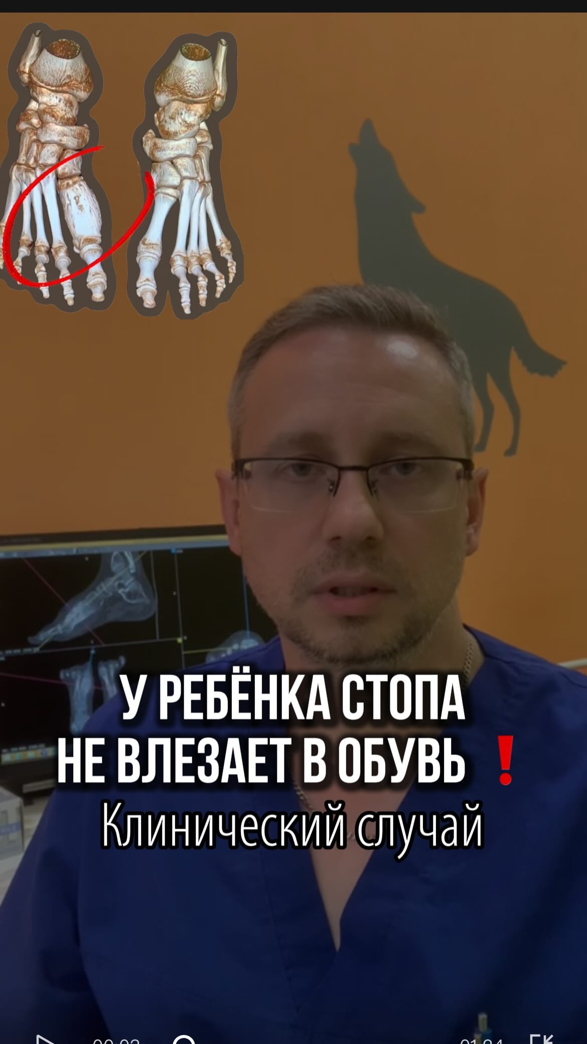 doc_malamashin в LOOKY. #детскийортопед,#дети,#диагностика,#консультацияврача,#история,#случай,#ортопед. До сих пор я не пере...