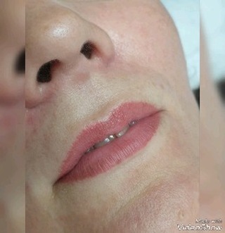 beautiful_skin_vl в LOOKY. #владивосток,#релатоксвл,#косметологиявл,#губывладивосток,#желтыйпилингвл,#нитивл. Контурная пластика г...
