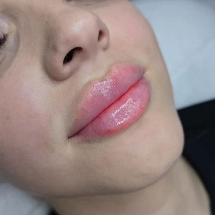 beautiful_skin_vl в LOOKY. . null