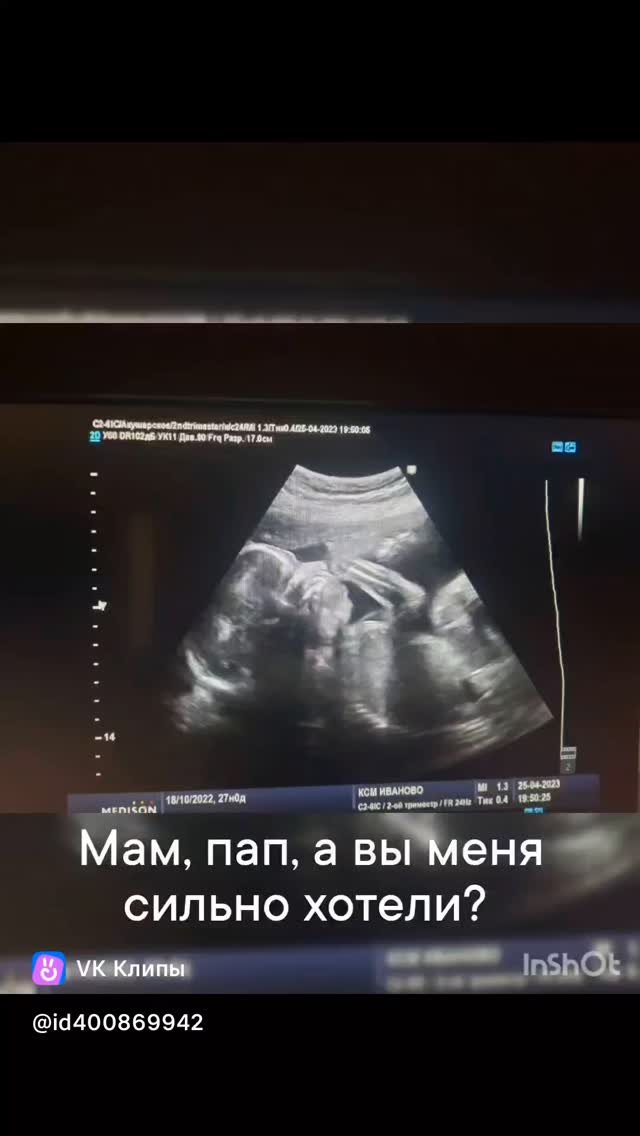 iksanova.official в LOOKY. #семья,#дети,#любовь. Просто без слов...

...